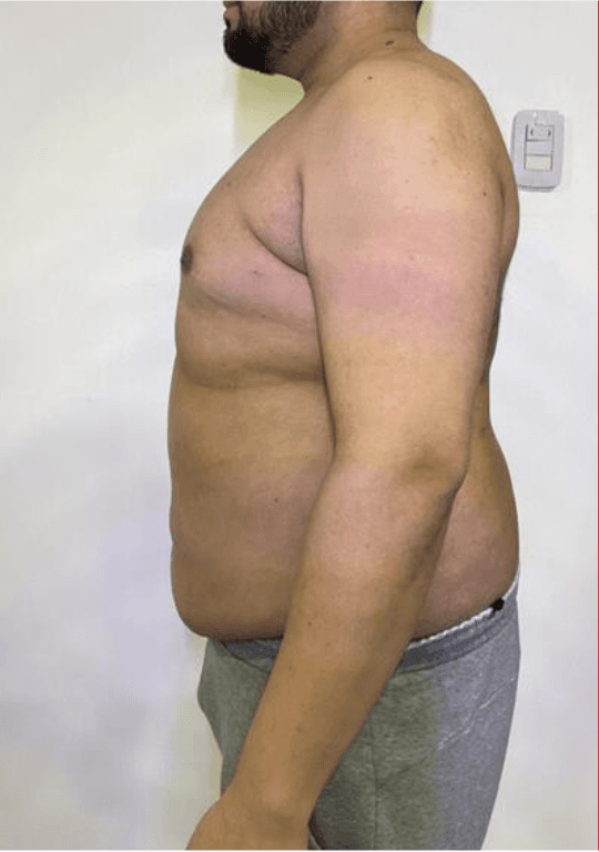 Maximiliano - Antes