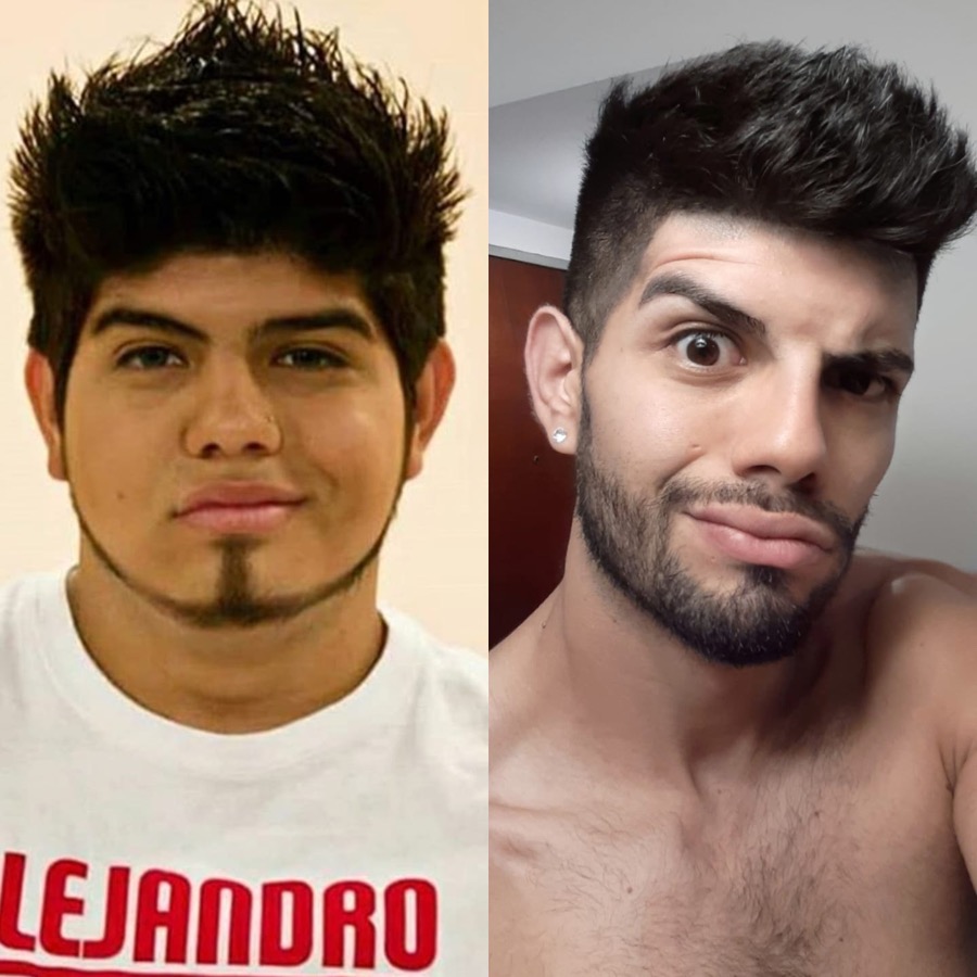 Alejandro Gerez — antes y después